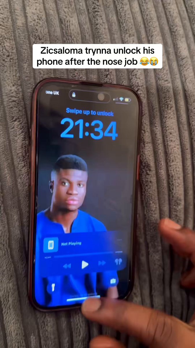 Zicsaloma trynna unlock his iPhone after the nose job 💀💀💀💀💀💀💀💀💀💀