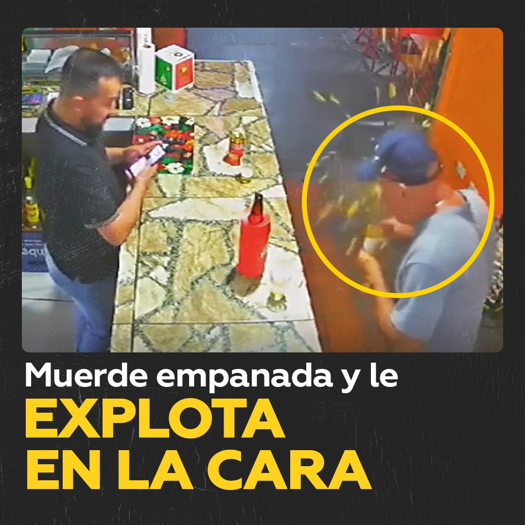 💥 Cliente de un puesto de comida rápida en Brasil sufre una explosión sorprendente al morder una ‘coxinha’ de pollo (empanada).