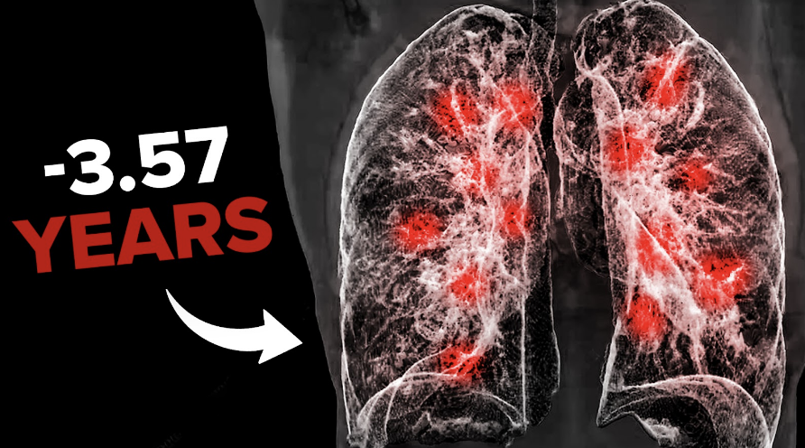 We know about things that kills us immediately: poison and accidents. Air pollution kills slowly. Here’s how you can improve the quality of the air you are breathing.