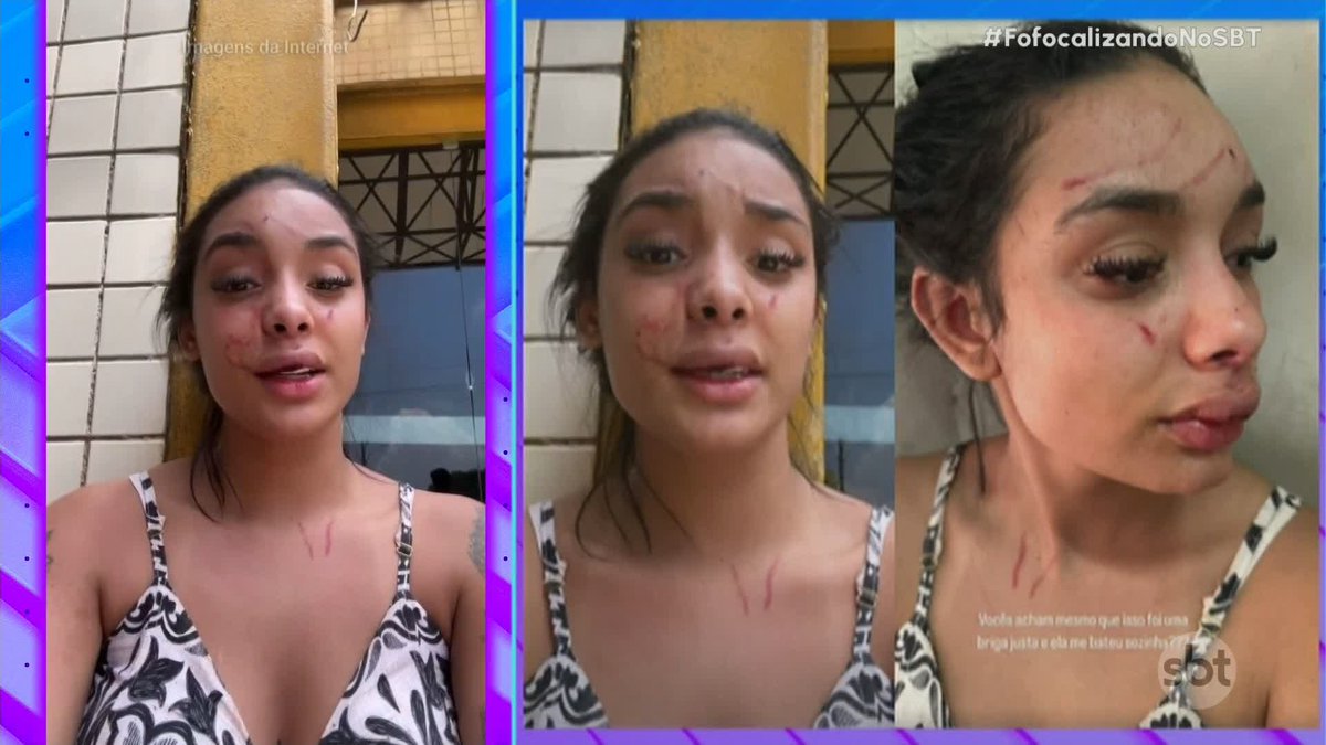 Moça, que ficou desacordada em briga, afirma que Bia Miranda não brigou sozinha. Após briga, Gato Preto se pronuncia: "Se depender de mim, ninguém encosta nas minhas mulheres" #FofocalizandoNoSBT