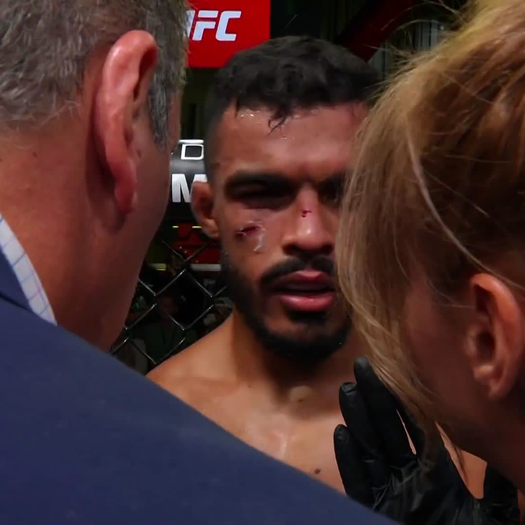 This fight has been ended due to doctor stoppage. Nazim Sadykhov is leaving #UFCVegas102 with the victory!