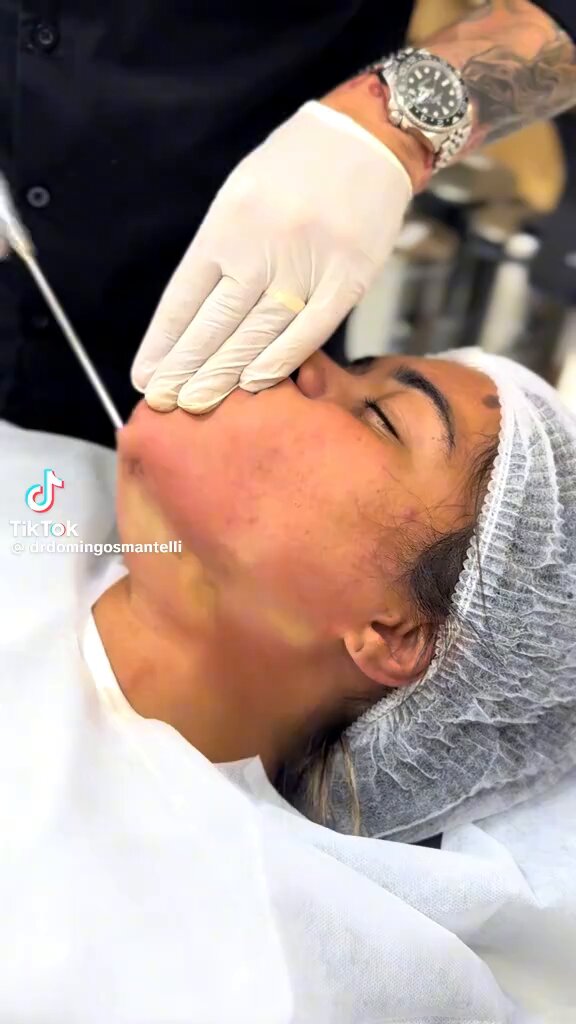 o fato de ser um profissional não médico cirurgião plástico realizando algo tão invasivo só me faz pensar na coragem de quem confia