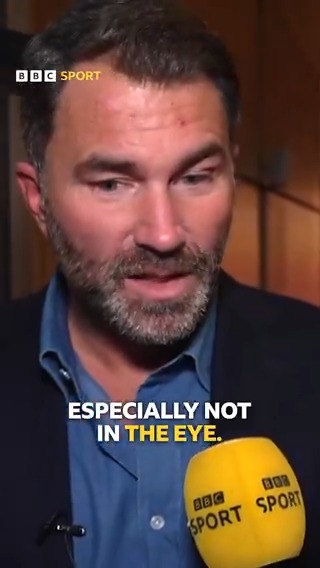 Eddie Hearn is a concerned man after the Chris Eubank Jr. and Conor Benn egg incident 🥚 #BBCBoxing