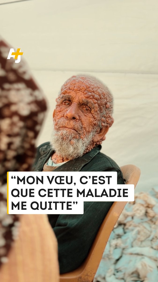 Fathi El-Jadd, Palestinien déplacé à Gaza, souffre d’une maladie de la peau depuis 1967, aggravée par la guerre, le manque d’eau et l’absence de produits d’hygiène.