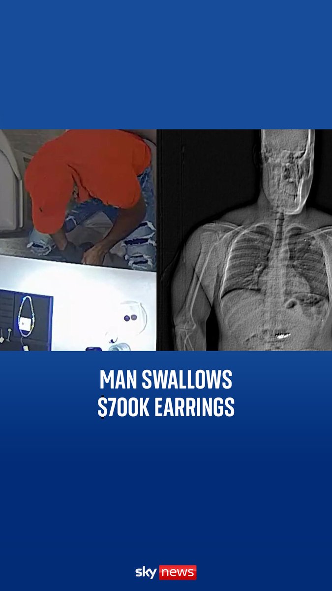 Police say a man in Florida pretended to represent a professional athlete to gain access to expensive jewellery which he then stole. A body scan taken after his arrest showed objects in his system.