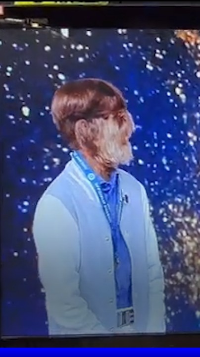 Atteint du "syndrome du loup-garou", cet Indien de 18 ans détient le record du monde du visage le plus poilu