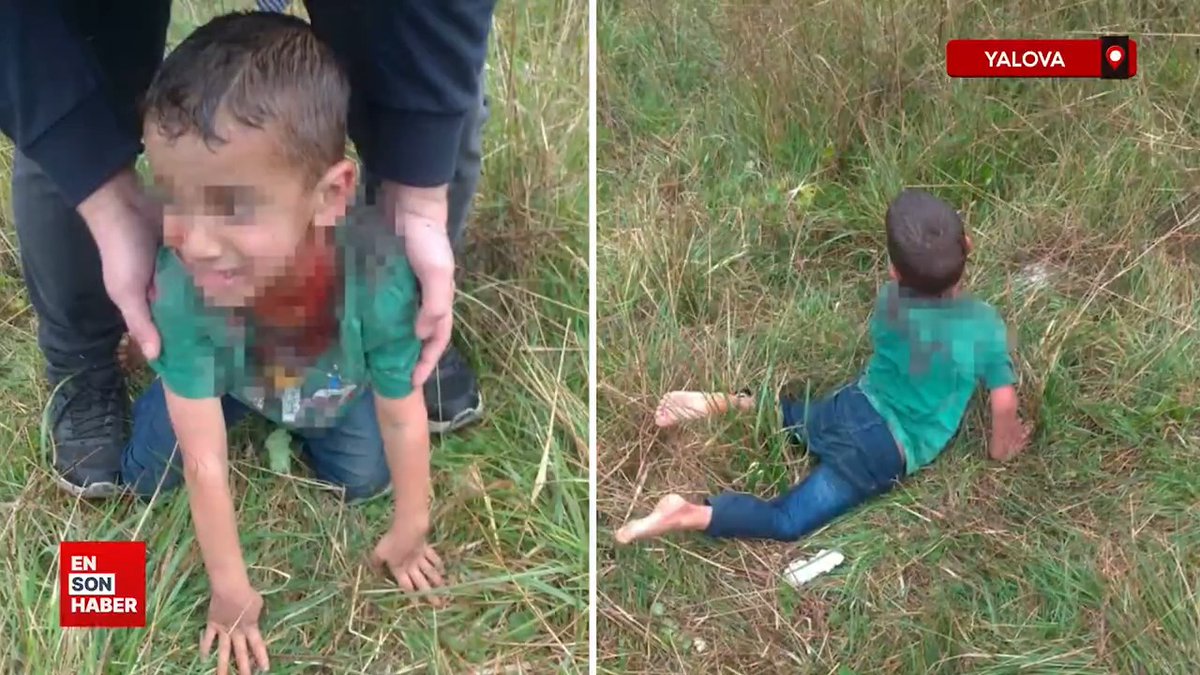 Yalova'da başıboş sokak köpeklerin saldırısına uğrayan 5 yaşındaki çocuk ağır yaralandı! "Soluk borusu, boğazı çok zarar görmüştü. 5-6 tane yarası vardı. Zor nefes alıyordu. Ağlamaya çalışıyor ama ağlayamıyordu."