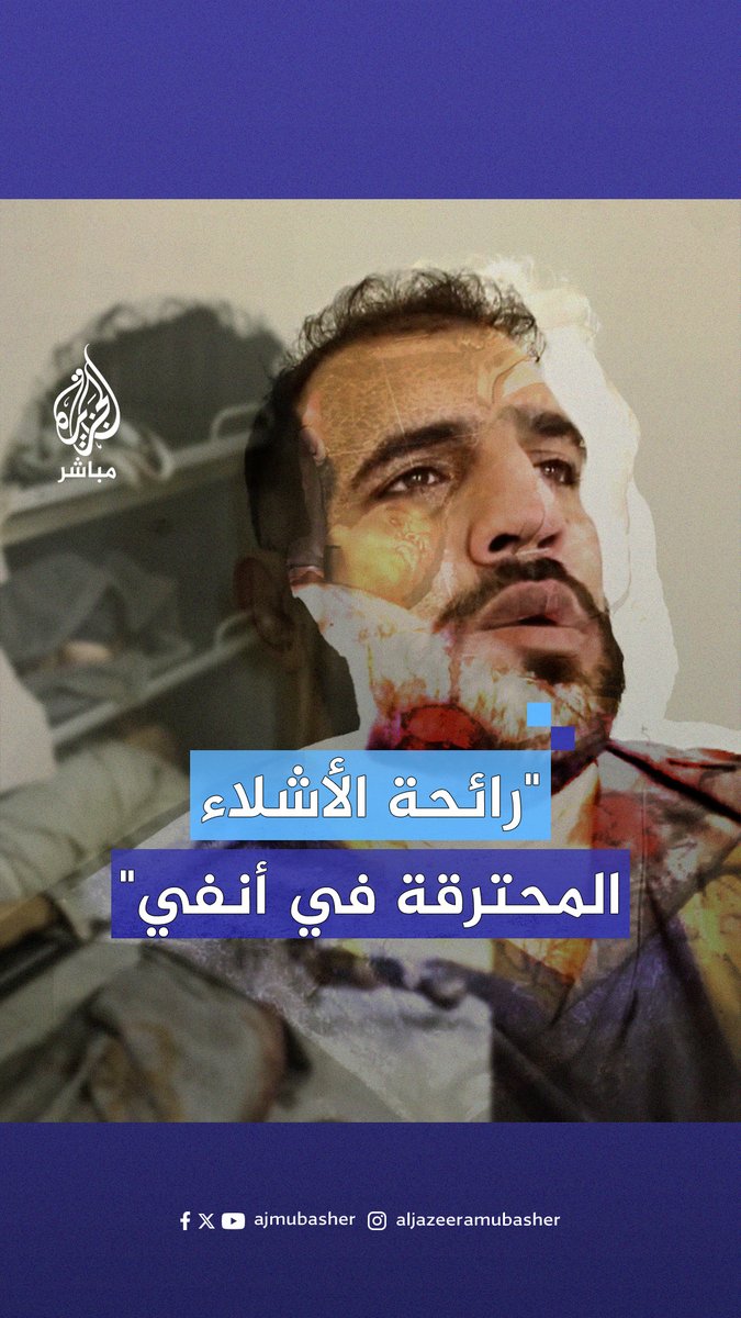 "الأطفال محترقون وأطرافهم مفقودة".. طبيب أسترالي يروي هول ما شاهده ليلة المـجـ.ـزرة الإسرائيلية في قطاع #غزة بعد أكثر من شهرين من وقف إطلاق النار #الجزيرة_مباشر #غزة_لحظة_بلحظة
