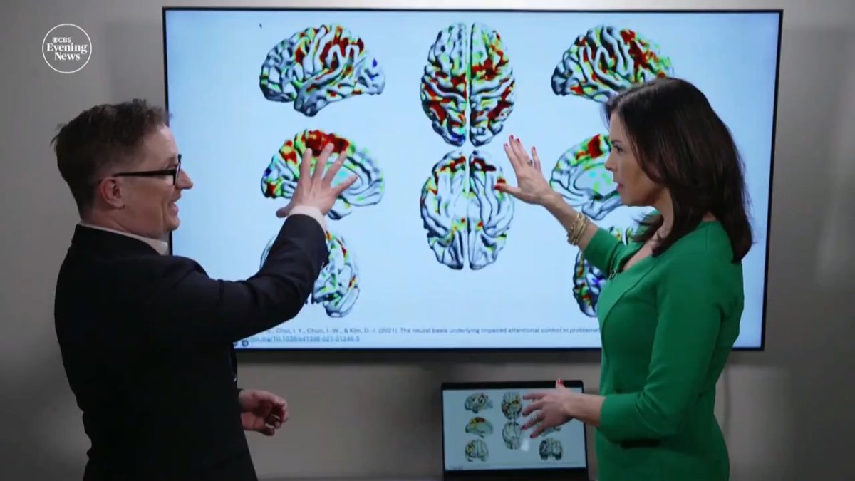 Research shows excessive phone use alters the brain, making users less attentive and more prone to mental health struggles. Experts say the key to breaking "brain rot" may be going analog with hobbies away from a digital screen.