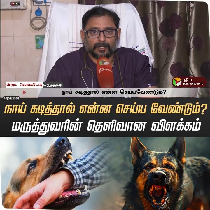 நாய் கடித்தால் என்ன செய்ய வேண்டும்? - மருத்துவரின் தெளிவான விளக்கம் #Dog | #DogBite | #Rabies | #Vaccine