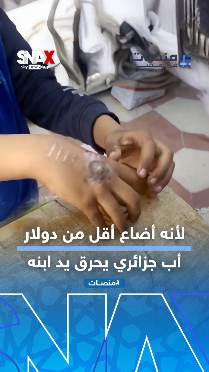 حادثة تهز الجزائر.. الصدفة تكشف تعذيب والد لابنه بالحرق لأنها أضاع أقل من دولار واحد #منصات #SNAX
