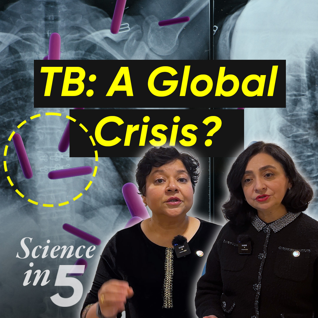 Severe resource shortages are threatening the global response to end #tuberculosis (TB). Is the world on the brink of a global TB crisis? A quarter of the world’s population could be infected with TB and not even know it. Listen in to Dr Tereza Kasaeva on Science in 5. #EndTB