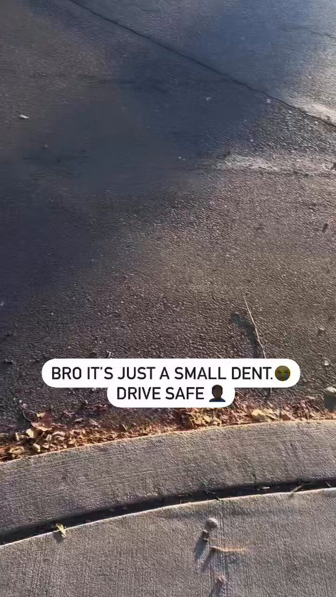 It’s not that serious bro