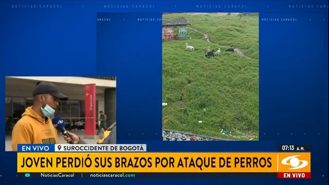 Una verdadera tragedia está viviendo una familia en la localidad de Bosa, en el sur de Bogotá, luego de que un joven de 19 años fuera atacado por una manada de perros callejeros. La víctima perdió los dos brazos y su estado de salud es delicado. Más en