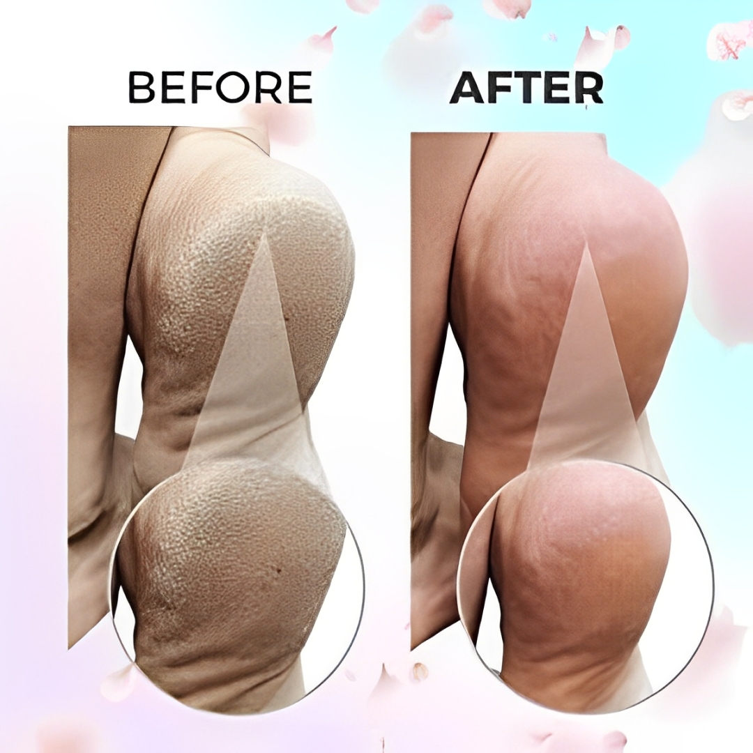 Say goodbye to rough feet! Smooth your skin effortlessly with our electric foot grinder. Get yours: