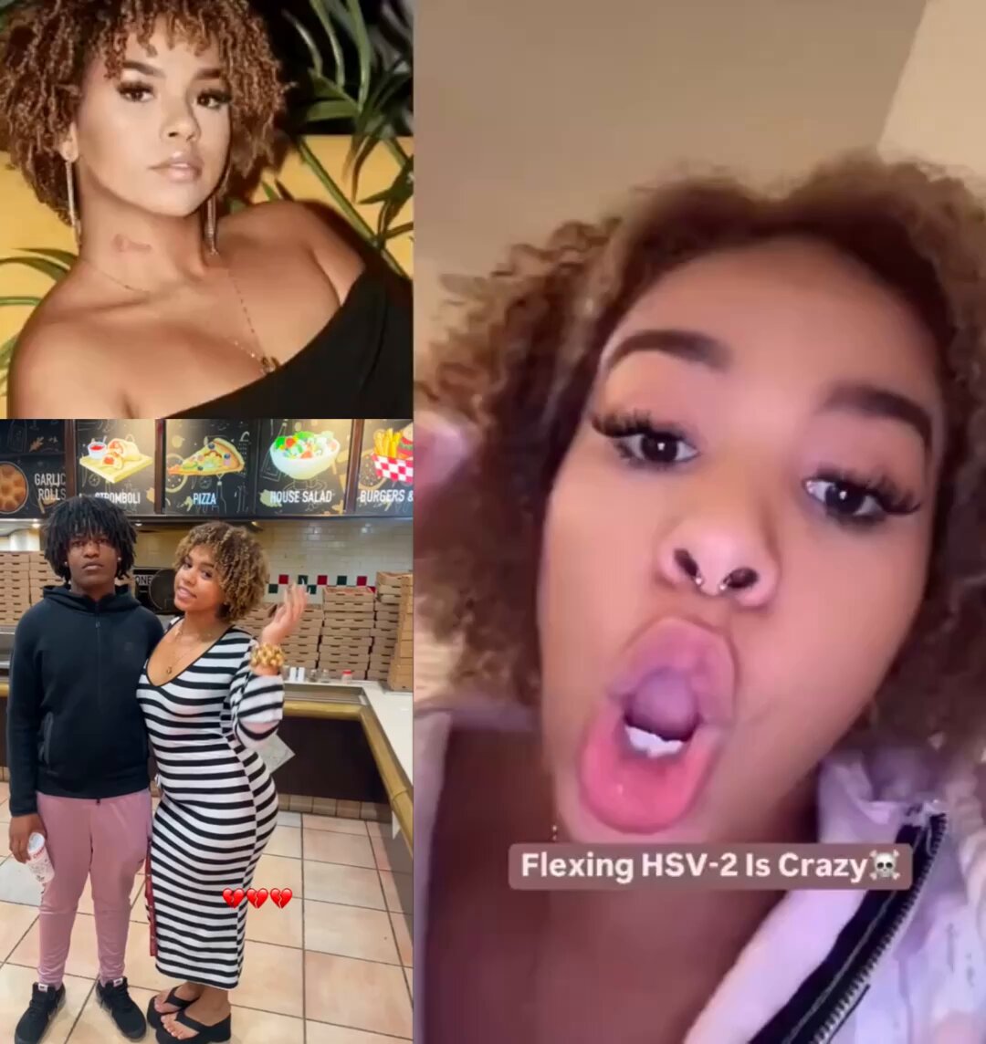 Woman who went viral after crying &amp; publicly admitting she was burning &amp; infected with HSV-2 is back &amp; says she is spreading the STD around to men because they are “fein’s” 😳🙏🏽