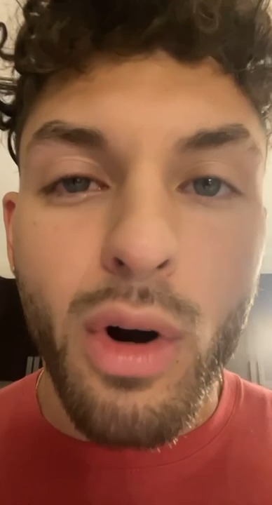 do I look like I have pinkeye be honest ..