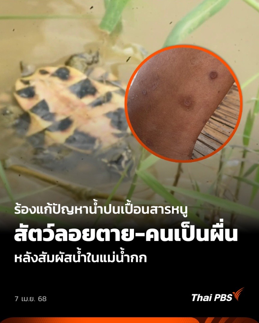 พบสัตว์น้ำในแม่น้ำกกตายไม่ทราบสาเหตุ หลังตรวจพบ “สารหนู” เกินค่ามาตรฐาน ขณะที่ชาวบ้านบางคนมีอาการผื่นคัน หลังสัมผัสน้ำในแม่น้ำกก จึงอยากเรียกร้องให้หน่วยงานที่เกี่ยวข้องเร่งหาทางไขปัญหา 🎬 ชม #ข่าวค่ำ ได้ที่ #ThaiPBS #ข่าวไทยพีบีเอส #ข่าวที่คุณวางใจ