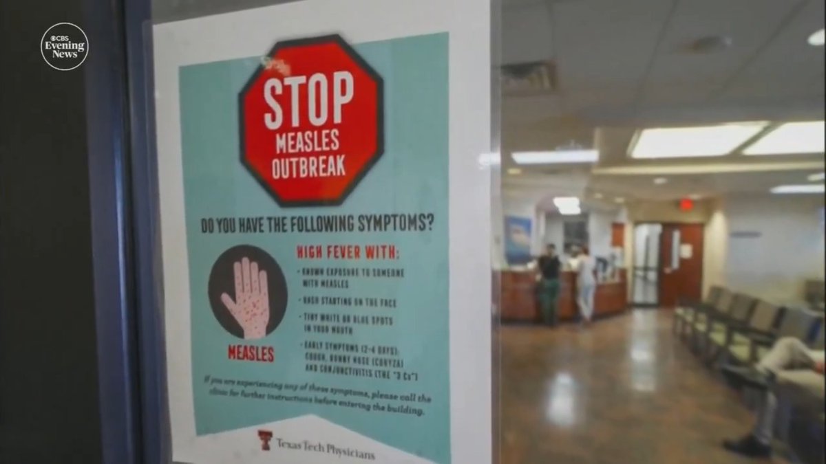 A second unvaccinated child has died of measles in west Texas. The virus has also spread to a daycare in Lubbock, infecting seven children, with one hospitalized, as the county is added to the state's outbreak zone.