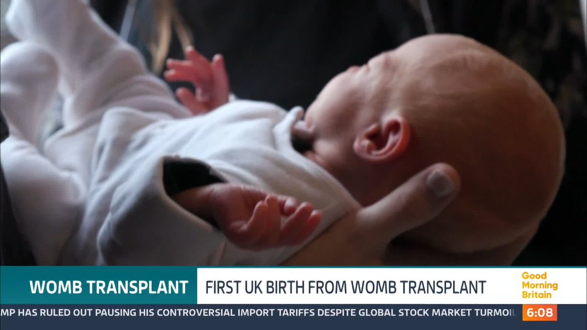 A London woman born without a womb has been the first in the UK to give birth after a successful womb transplant. Grace and Angus Davidson welcomed their baby girl Amy Isabel five weeks ago - naming her after two special women who made this breakthrough possible.