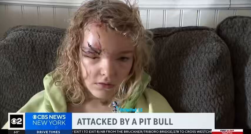 NEW: 9-year-old Long Island girl suffered severe injuries, including a partially detached ear, after being viciously mauled by a neighbor’s pit bull Daniella Schlauch was attacked by a dog outside her house as she was exiting her car Her father, Pat Schlauch, intervened to protect her The dog’s owner arrived and called the dog off Daniella sustained a concussion, wounds to her head, hand, and foot, and required hundreds of stitches and staples She will need to visit a plastic surgeon in the coming weeks