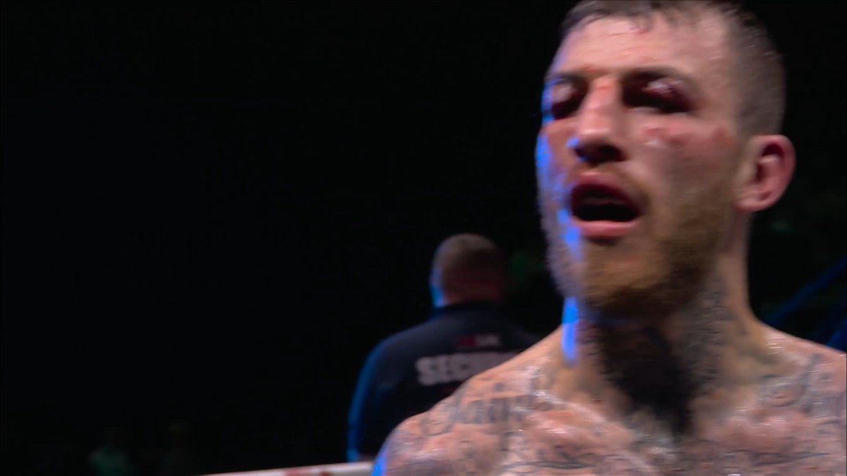 THE FIGHT IS OVER! ❌ Mark Bates brings in the doctor, who has a quick look at Sam Eggington's bloodied eyes and waves off the fight - we go to the scorecards 👀 #WhittakerCameron2 | Live NOW on Sky Sports