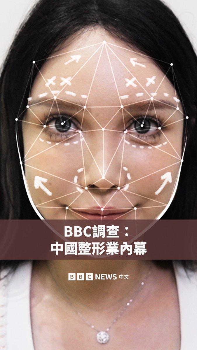 【BBC调查：中国整形热潮内幕】 整形手术曾在中国被视为禁忌，但在过去十年间，它变得愈来愈受欢迎。在社交媒体的推波助澜下，“颜值”被认为是事业成功的重要元素。 具备脸部扫描AI功能的美颜应用程式吸引了数百万用户，只需点撃一下就可以预约手术。然而，需求暴增也导致有资质的医生和诊所短缺，导致整形失败案例不断增加。 ▶️观看全片：