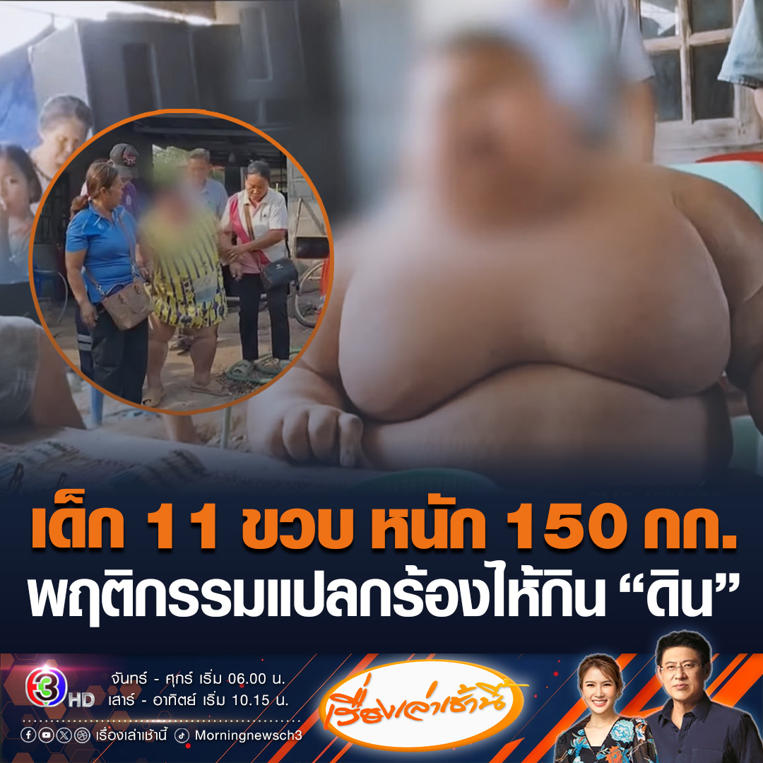 #เรื่องเล่าเช้านี้ ตะลึง พบเด็กชาย 11 ขวบ น้ำหนัก 150 กิโลกรัม ป่วยประหลาด ชอบกิน “ดิน” เป็นอาหาร ถ้าไม่ได้กินจะร้องไห้ ชาวบ้านช่วยหามส่งตรวจร่างกาย #ข่าวช่อง3 #ข่าวภูมิภาค