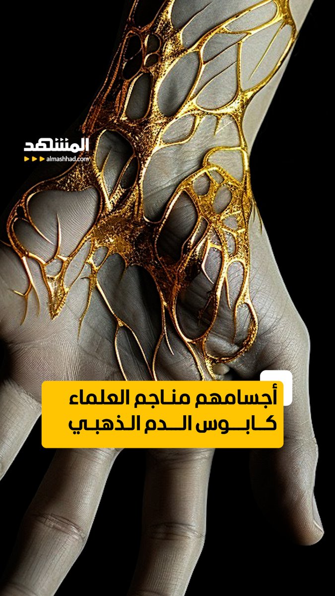 43 شخص فقط في العالم يحملون فصيلة الدم الذهبية ولماذا هي كنز ؟
