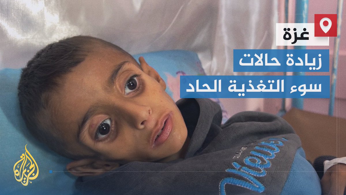 ارتفاع أعداد الأطفال الذين يعانون من سوء التغذية الحاد في قطاع #غزة نتيجة إغلاق الاحتلال جميع المعابر ومنع دخول المساعدات الغذائية | إعداد: هشام زقوت #حرب_غزة #الأخبار
