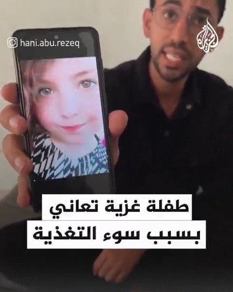 "نفسي أمشط شعري وأرجع زي ما كنت".. الطفلة رهف عياد من حي الشجاعية في #غزة تعاني من سوء التغذية بسبب سياسة التجويع التي يتبعها الاحتلال بإغلاقه المعابر وعدم إدخال المساعدات للقطاع #حرب_غزة #فيديو