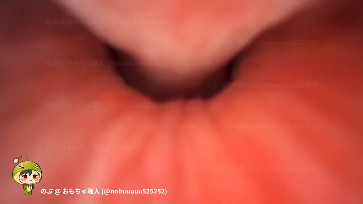 前立腺の手前から奥にかけての映像です。 画面上方は背中側、下方は腹側です。 途中、シリンジで生理食塩水を吹きかけながら前立腺小室の開口部を観察してます。