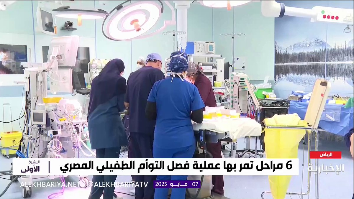 الوضع الصحي للتوأم الطفيلي مستقر.. رئيس فريق التخدير د. نزار الزغيبي لـ #الإخبارية: انتهاء المرحلة الأولى من العملية والبدء في المرحلة الثانية #النشرة_الأولى