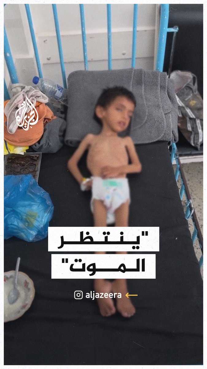 "هل ترضون أن يحدث هذا لأطفالكم؟".. سوء التغذية يحول طفلًا فلسطينيًا إلى هيكل عظمي في قطاع #غزة جراء استمرار الحصار والحرب #حرب_غزة