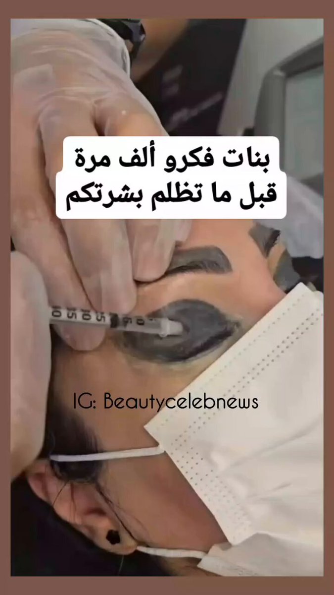 وجه سيدة بعد اجراء حقن المكياج الدائم 😰!!!