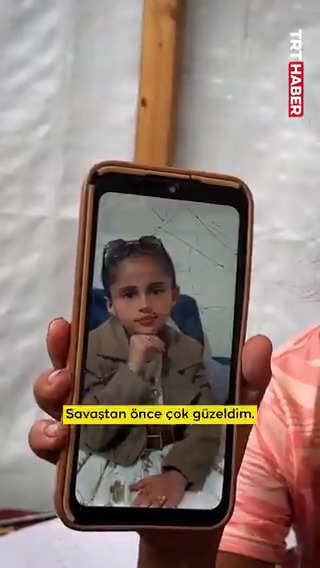 Henüz 10 yaşında Gazzeli Lana… Katil İsrail’in bombardımanında hayatta kalmayı başardı, ama korku ruhunda ve bedeninde hasar bıraktı. Saçları bir gecede ağardı, cildini lekeler sardı. Küçük Lana, yine eskisi gibi olmak istiyor: Ben eskiden güzeldim...