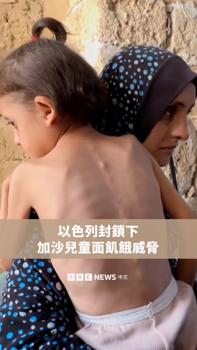 在以色列对加沙的援助封锁进入第三个月之际,数十万名儿童正面临饥饿危机。联合国官员拉札里尼指控以色列将粮食作为战争武器使用,而以色列则否认并称其行动是为了“自卫”与“打击哈马斯”。