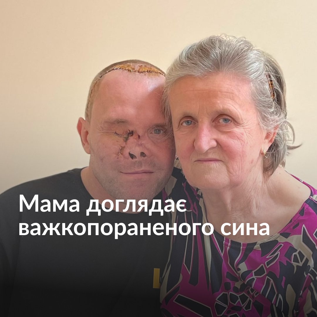 «Протез на руку є, на ногу є, обличчя зроблять — і ми поїдемо додому», — каже Віра Овсяннікова, мати важкопораненого військового. Вона майже два роки живе з сином у лікарняних палатах. Володимир переніс 40 операцій, попереду — ще 5. Як мама стала для нього найбільшою підтримкою — дивіться у відео