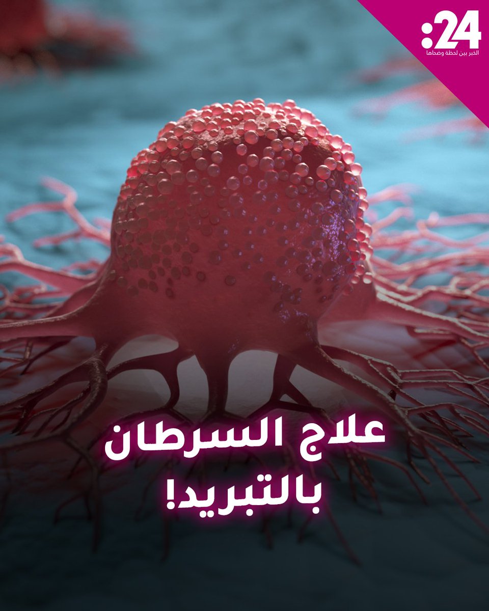 دون جراحة وشفاء في ساعات! #روسيا تبتكر تقنية جديدة تذيب السرطان لمشاهدة المزيد من الفيديوهات: