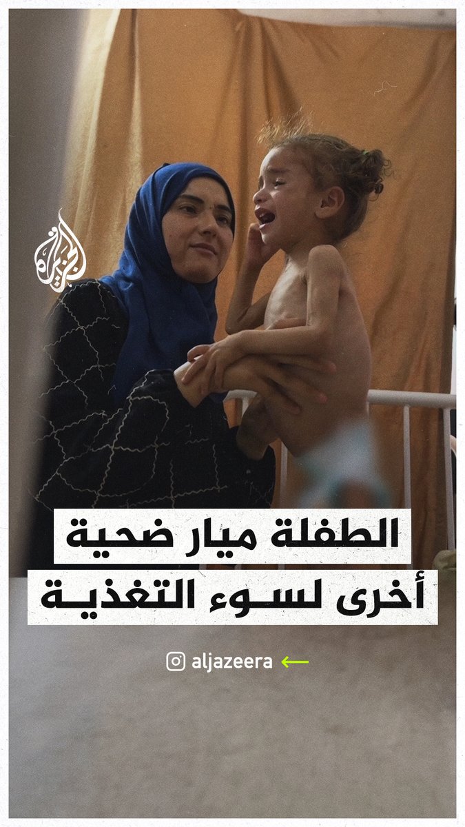 ميار العرجا.. طفلة فلسطينية تبلغ من العمر عاما ونصف تعاني من سوء التغذية الحاد جراء شح المواد الغذائية في قطاع #غزة نتيجة استمرار الحصار الإسرائيلي #حرب_غزة