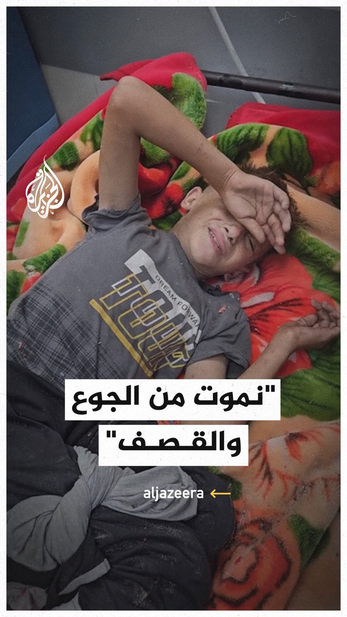 منهم طفلة فقدت عائلتها وطفل آخر تعرض لجروح صعبة في قدمه.. أطفال يئنون من ألم الإصابة بقصف الاحتلال على منطقة المواصي في خان يونس جنوبي قطاع #غزة #حرب_غزة