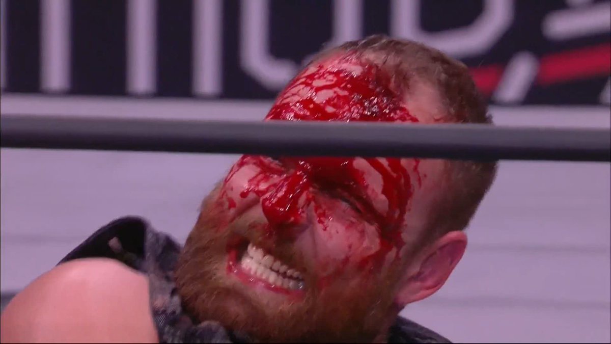 Eddie Kingston covered in blood while waking with a gasoline canister during Anarchy in the Arena in 2022 is one of the craziest visuals in AEW history.