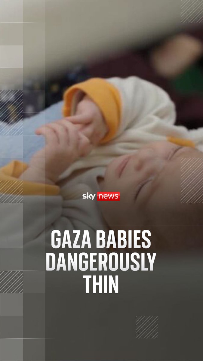 Our team in Gaza filmed with baby Aya at the Rantisi hospital in northern Gaza. She is now 3 months old and dangerously thin. Her skin stretches over her cheekbones and eye sockets on her gaunt, pale face. Alistair Bunkall reports ⬇️