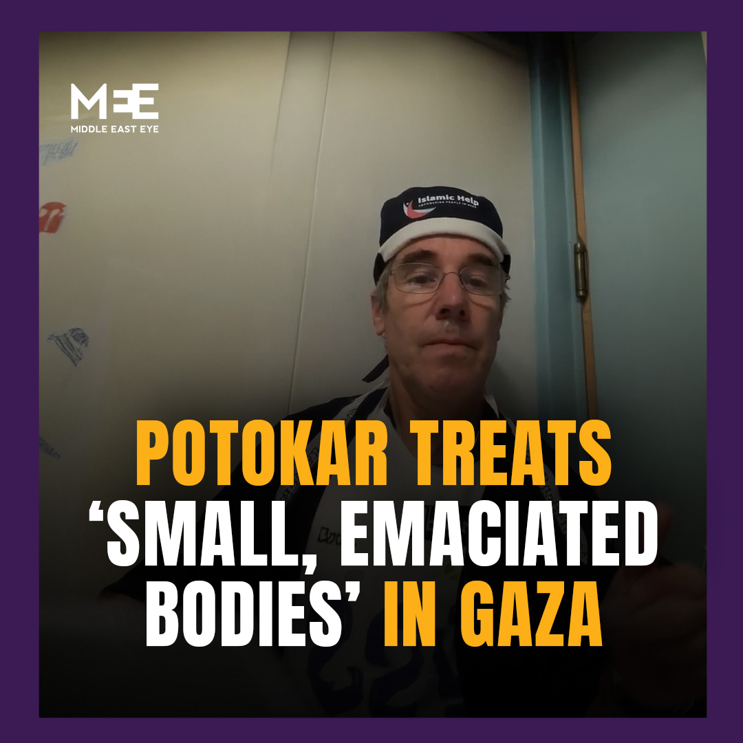 British surgeon Doctor Tom Potokar who is currently working in Gaza called on world leaders to take urgent action to end the war. After another day operating on severely injured children, he described the conditions as dire with young patients suffering from extreme malnutrition