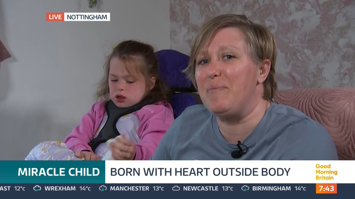 Vanellope Hope Wilkins was born with her heart outside of her body, caused by a condition called Ectopia cordis. The miracle baby beat eight-million-to-one odds of living, Doctors say she is the first child in Britain to have survived the ultra-rare condition.