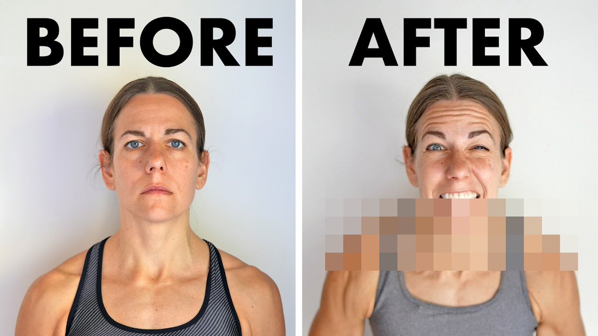 I spent 70 days getting a jacked neck