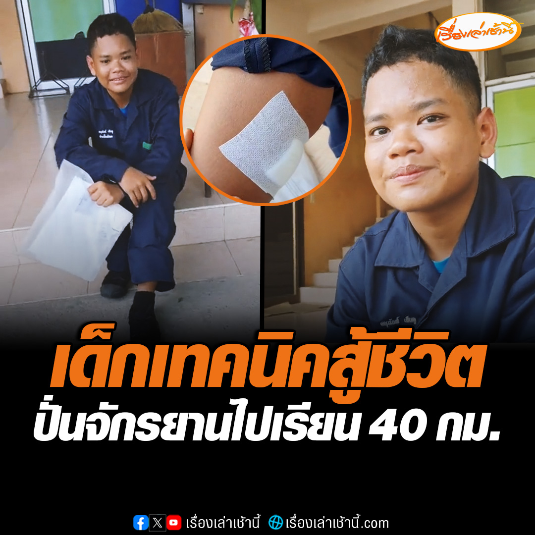 ฟังแล้วจุกอก! เด็กเทคนิคสู้ชีวิต ปั่นจักรยานเก่าไปเรียน วันละ 40 กิโลเมตร ซ้ำยังโดนหมากัดระหว่างทาง ผอ.รู้เรื่องยื่นมือเข้าช่วยแล้ว #เรื่องเล่าเช้านี้ #ข่าวช่อง3 #ข่าวโซเชียล #เด็กสู้ชีวิต