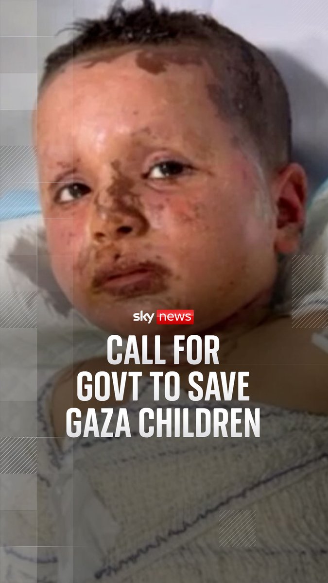UK charity calls on government to rescue two children in Gaza. Our special correspondent Alex Crawford spoke with doctors treating Haitham who are worried he might not survive. Watch our special programme on the impact of the war in Gaza at 9pm BST 👉