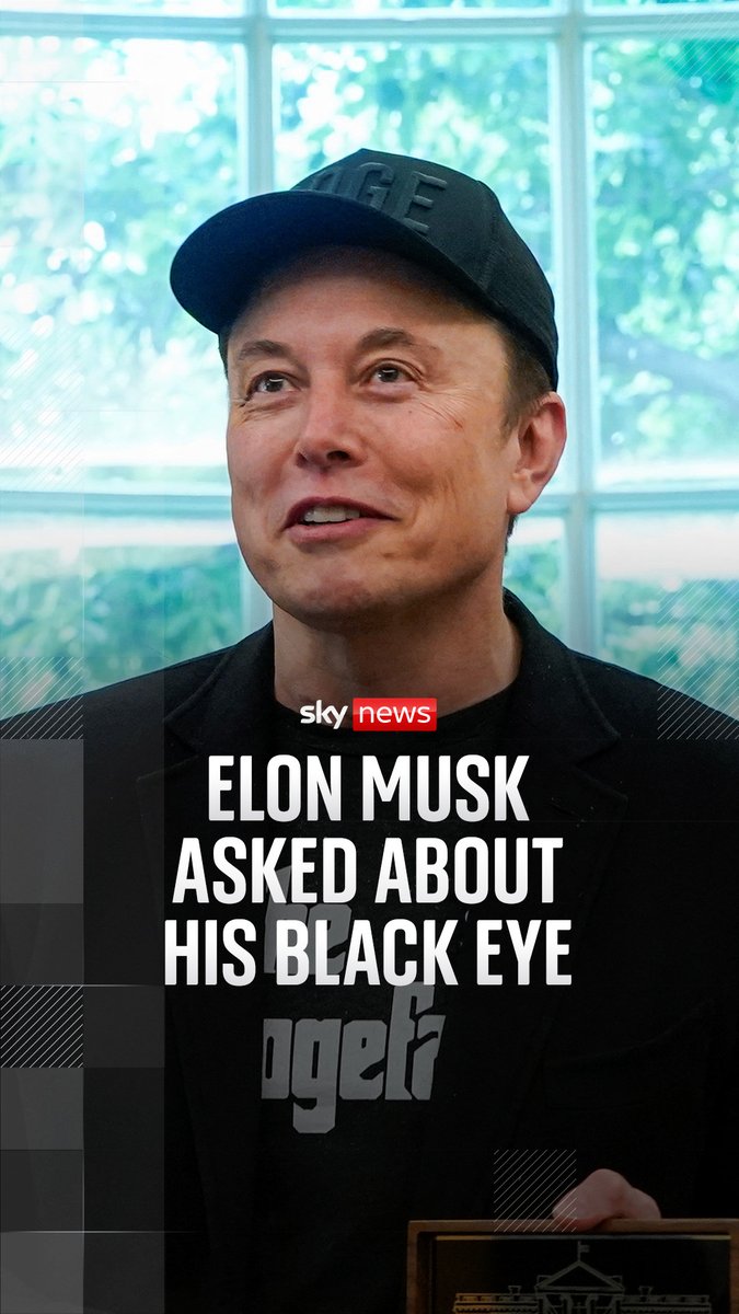 'Is your eye okay?' Elon Musk was asked about the visible bruising around one of his eyes - and says his five-year-old son X Æ A-12, or X for short, is responsible. More here as Trump and Musk appear together at White House: