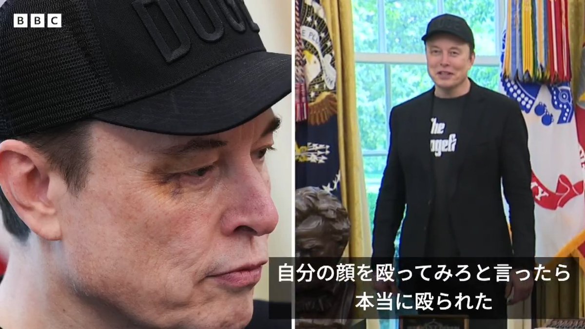 BBCニュース - 「息子に殴れと言って殴られた」、マスク氏の顔にあざ 米政権での「最終日」に会見